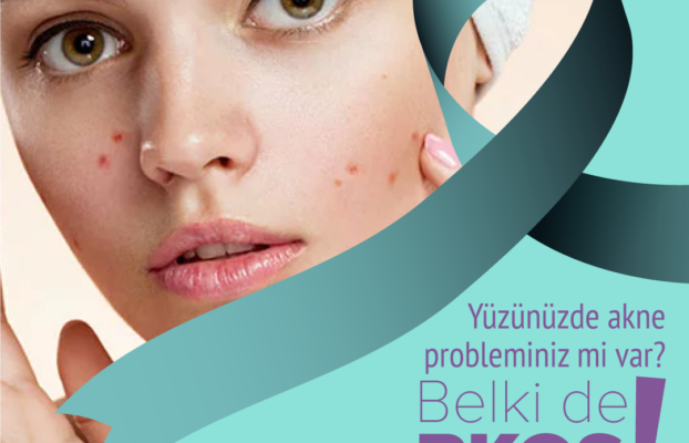 PKOS Sendromu Belirtileri Nelerdir?